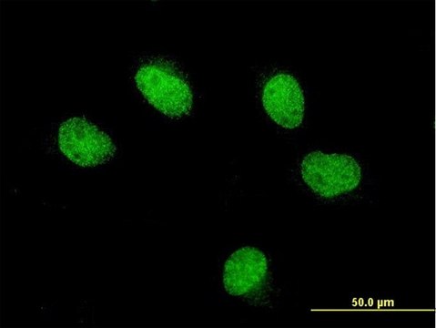 ANTI-FOXQ1 antibody produced in mouse