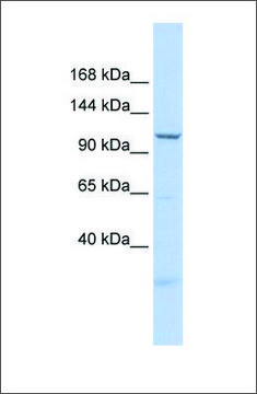 Anti-SKIV2L2 antibody produced in rabbit