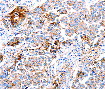 Anti-FOXD2 antibody produced in rabbit