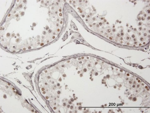 Anti-ING4 antibody produced in mouse