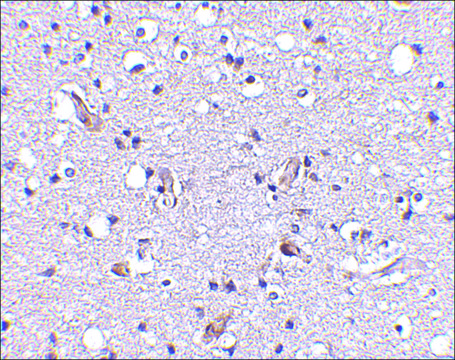Anti-Nhe-1 (ab1) antibody produced in