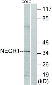 Anti-NEGR1 antibody produced in rabbit
