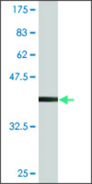 Monoclonal Anti-PEPP-2, (N-terminal) antibody produced