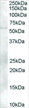 Anti-FAZF/TZFP/ZBTB32 antibody produced in goat