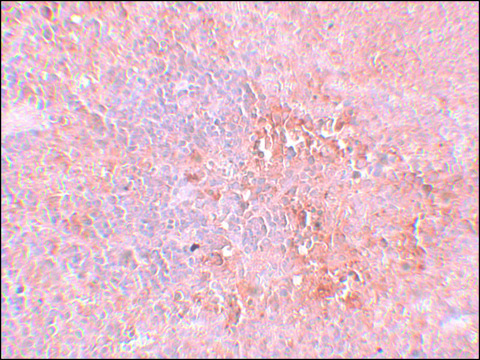 Anti-JMJD4 antibody produced in rabbit