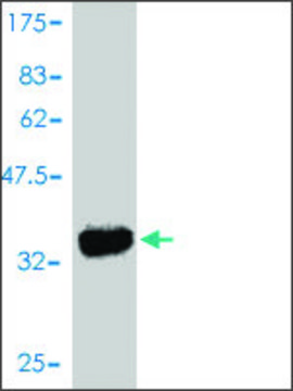 Monoclonal Anti-ROR1 antibody produced in