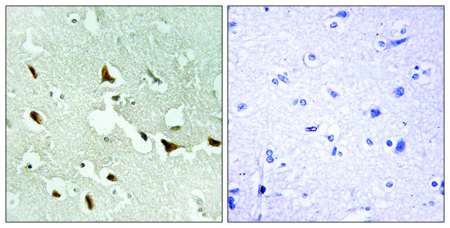 Anti-IRS-1 antibody produced in rabbit