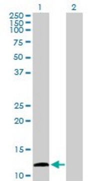 Anti-KISS1 antibody produced in rabbit