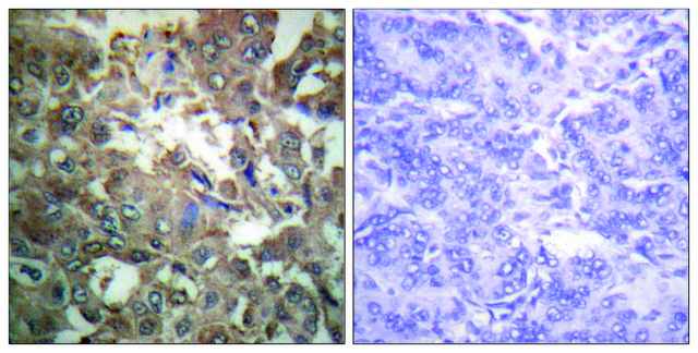 Anti-XPA antibody produced in rabbit
