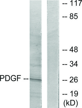 Anti-PDGFB antibody produced in rabbit