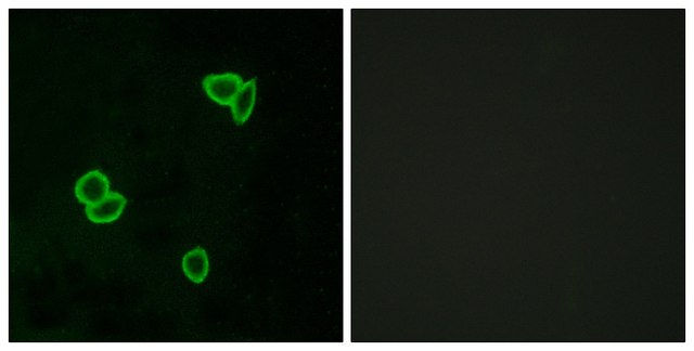 Anti-LPHN1 antibody produced in rabbit