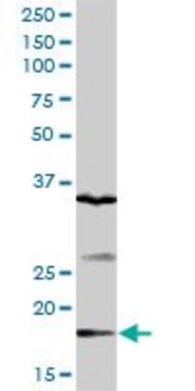 Anti-GEMIN6 antibody produced in rabbit