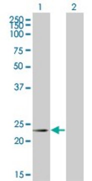 ANTI-RCV1 antibody produced in mouse