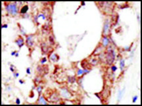 Anti-SENP3 (C-term) antibody produced in