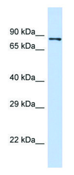Anti-PIEZO2 (N-terminal) antibody produced in