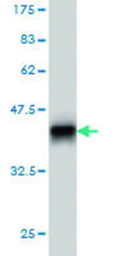 Monoclonal Anti-PPM1F antibody produced in