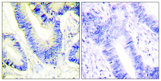 Anti-IRS-1 antibody produced in rabbit