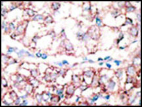 Anti-GJA3 (C-term) antibody produced in