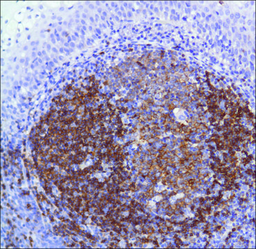 Anti-CD22 antibody, Rabbit monoclonal