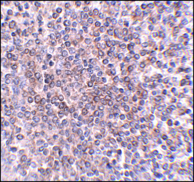 Anti-OCC-1 antibody produced in rabbit