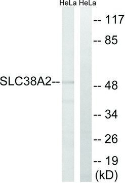 Anti-SLC38A2 antibody produced in rabbit