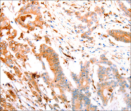 Anti-ABCA4 antibody produced in rabbit