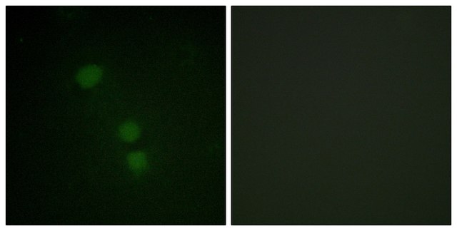 Anti-Histone H2B (Acetyl-Lys¹?) antibody produced