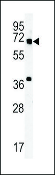 ANTI-MET10 (C-TERMINAL) antibody produced in