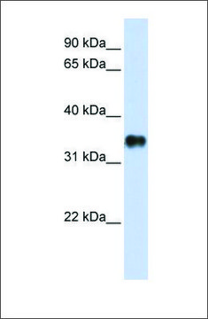 Anti-KCTD7 antibody produced in rabbit