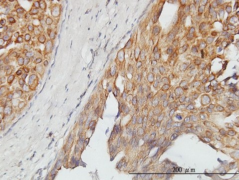 Monoclonal Anti-ASPSCR1 antibody produced in