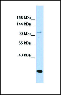 Anti-TRPC6, (N-terminal) antibody produced in