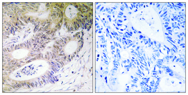 Anti-MSK1 antibody produced in rabbit