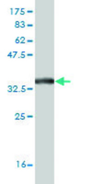Monoclonal Anti-SLC19A2 antibody produced in