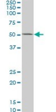 ANTI-CSNK1G2 antibody produced in mouse