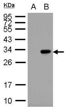 Monoclonal Anti-GST tag antibody produced