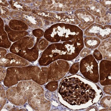 Anti-SMCO3 antibody produced in rabbit