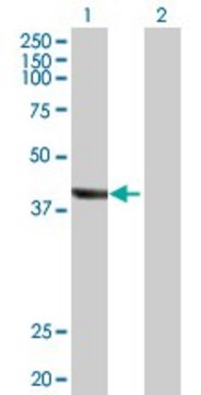 Anti-TRDMT1 antibody produced in rabbit
