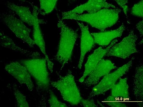 Monoclonal Anti-MGAT4B antibody produced in