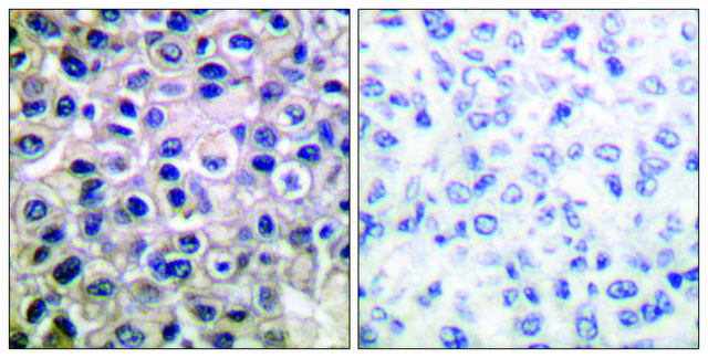 Anti-MMP-14 antibody produced in rabbit