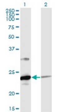 Monoclonal Anti-UBE2T antibody produced in