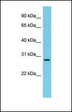Anti-DNAJB9, (N-terminal) antibody produced in