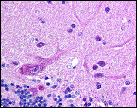Anti-RNF25 antibody produced in rabbit
