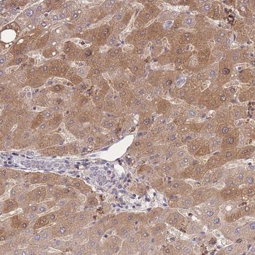 Anti-ZNF304 antibody produced in rabbit