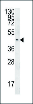 ANTI-PGAP2 (C-TERM) antibody produced in