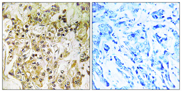 Anti-ZNF295 antibody produced in rabbit