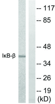 Anti-I?B-? antibody produced in rabbit