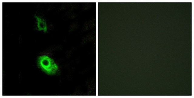 Anti-EDG3 antibody produced in rabbit