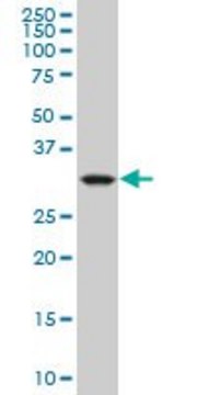 Monoclonal Anti-CRYM, (C-terminal) antibody produced