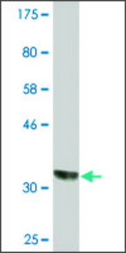 Monoclonal Anti-CSAD, (N-terminal) antibody produced