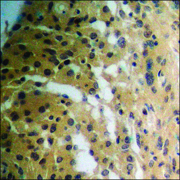 Anti-phospho-TK (pSer¹³) antibody produced in